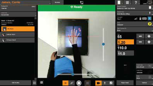 carestream-intelligence-patient-position-monitoring
