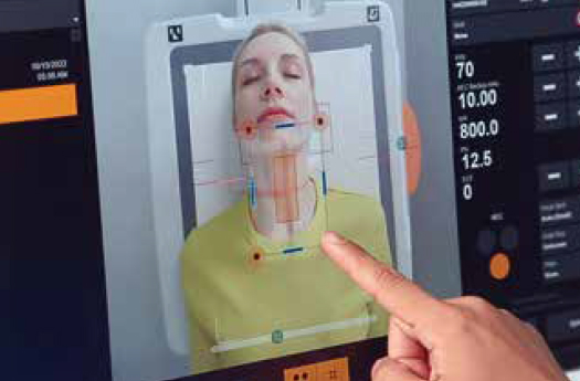 carestream-intelligence-virtual-collimation