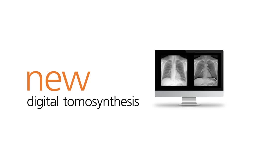 Eclipse - What's New? Dual Energy & Digital Tomosynthesis