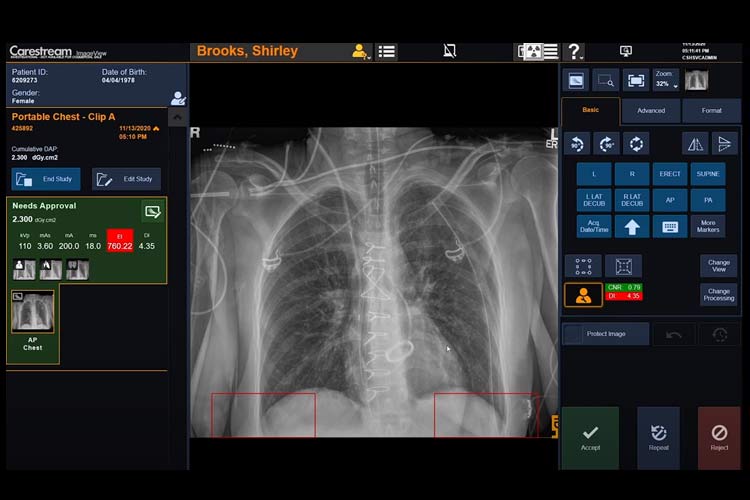 gallery2-vid-software-imageview-2