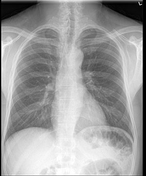 row-medical-software-std-crx
