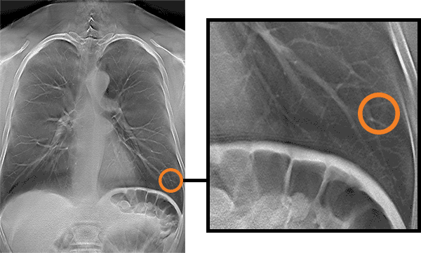row-medical-software-tomosynthesis