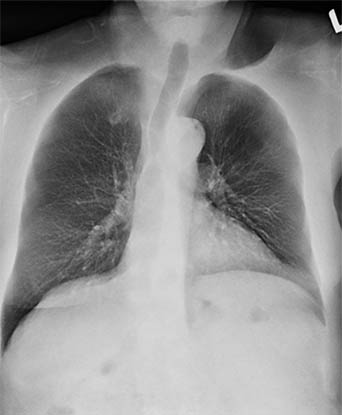 DE-Soft Tissue