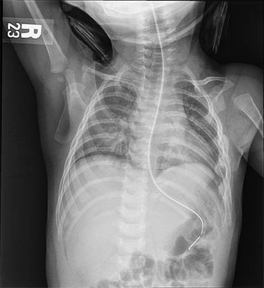 Pediatric_w