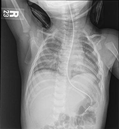 Pediatric_wo